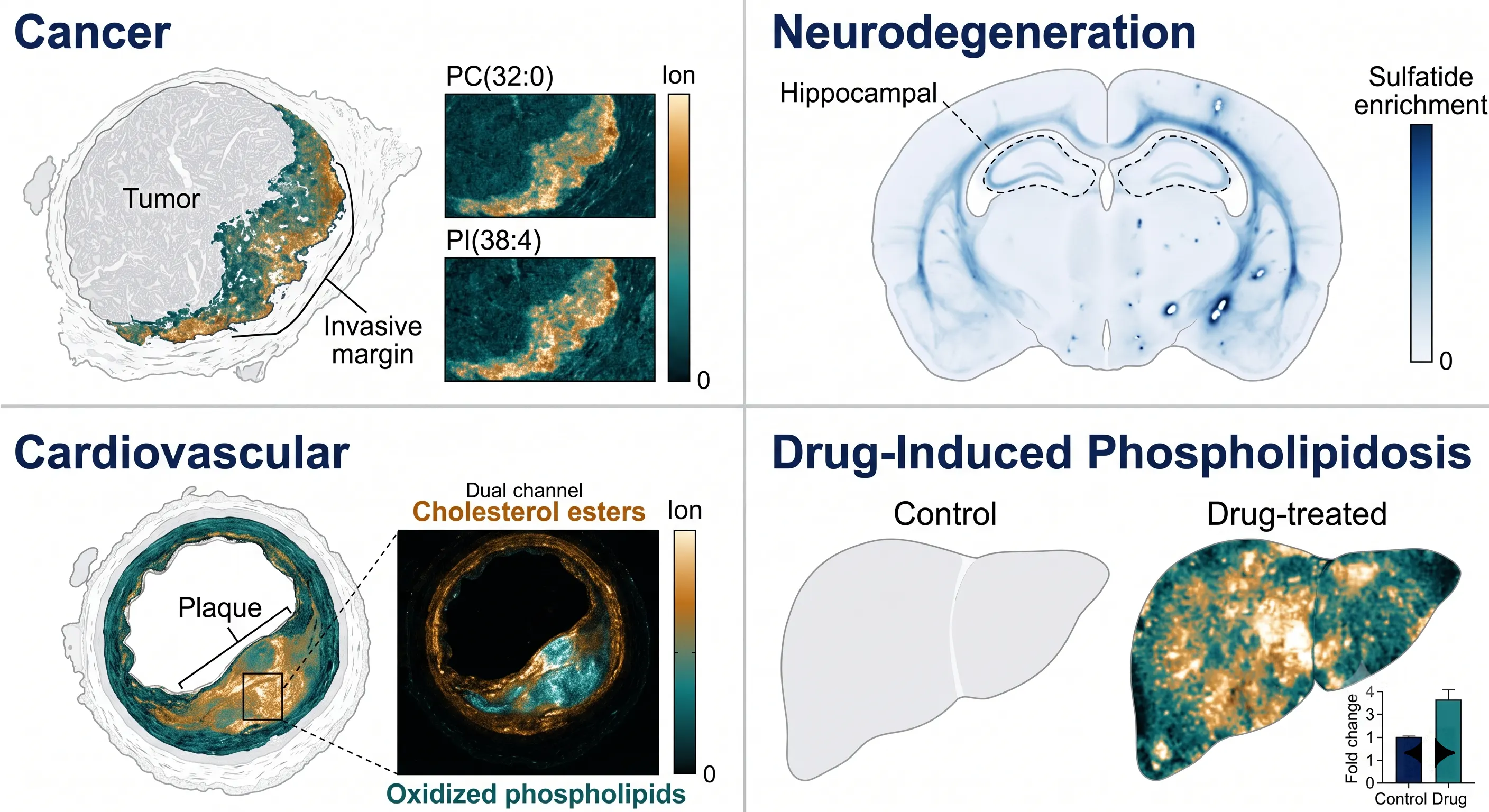 Application gallery — representative ion images from cancer, neurodegeneration, atherosclerosis, and drug-induced lipidomics studies.