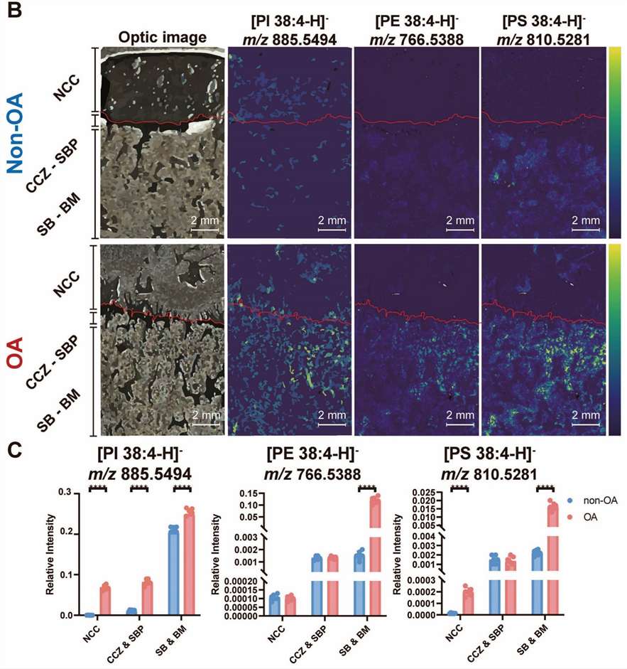 AA-containing phospholipids changes