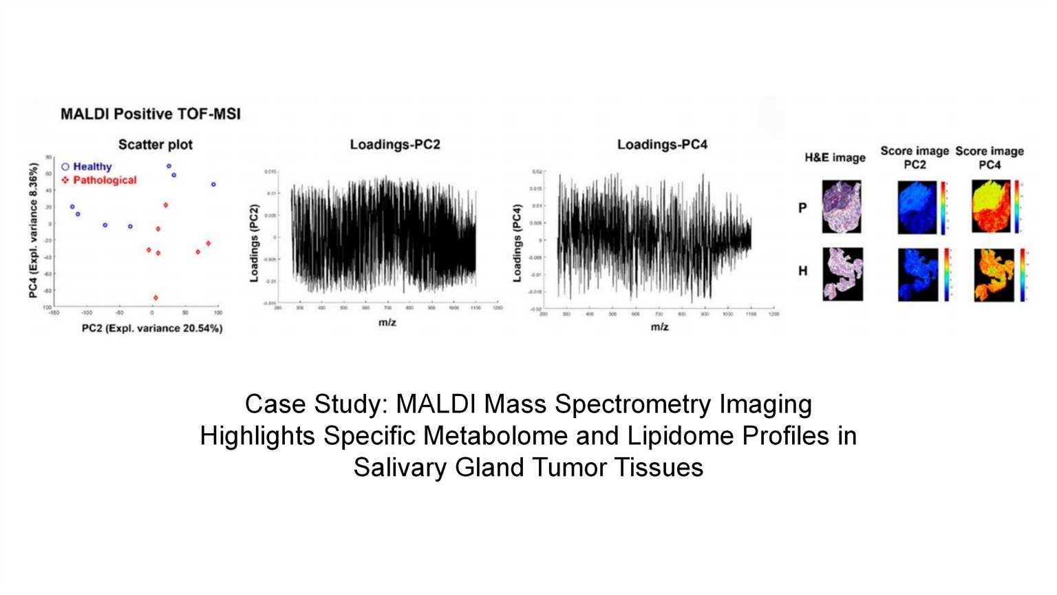 graphical abstract of Spatial Untargeted Lipidomics