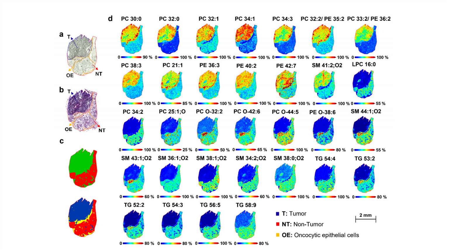 MALDI-MSI of different lipid molecules