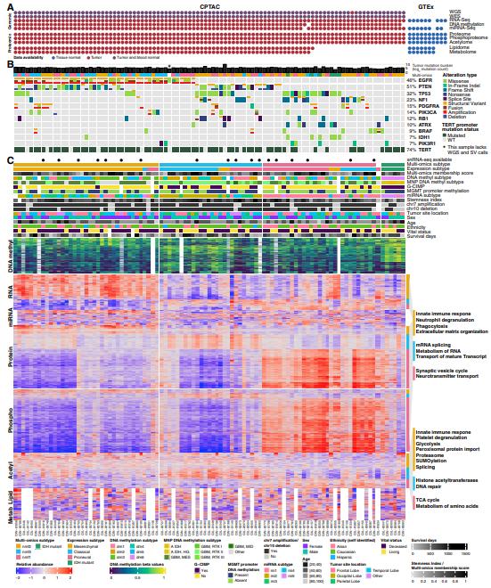 Unraveling the Molecular Complexity of Glioblastoma: Insights from Proteogenomic and Metabolomic Profiling