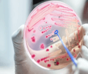 Venom-Based Antibiotic Development